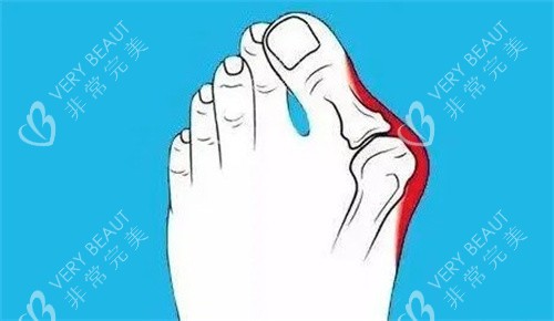 大腳骨是什么