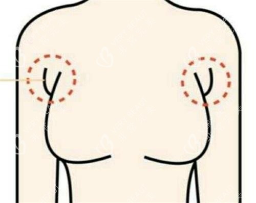 副乳的部位