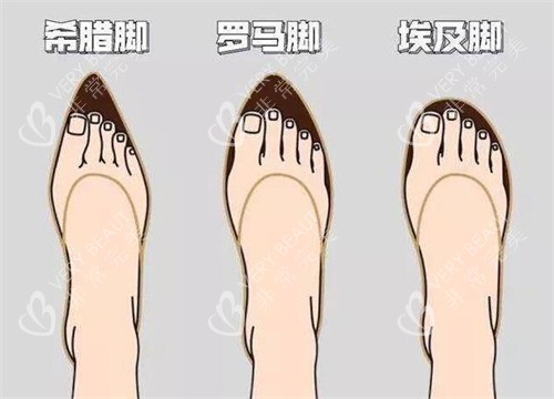 不同的脚型卡通图