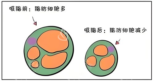 吸脂前后脂肪細(xì)胞對比動畫圖