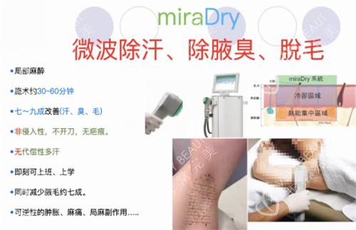 miraDry清新微波治疗过程