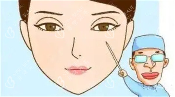 雙眼皮疤痕修復手術