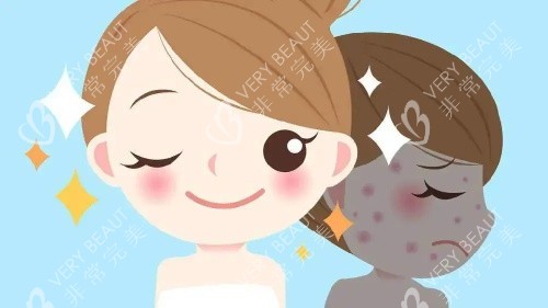 光子嫩膚后的成效