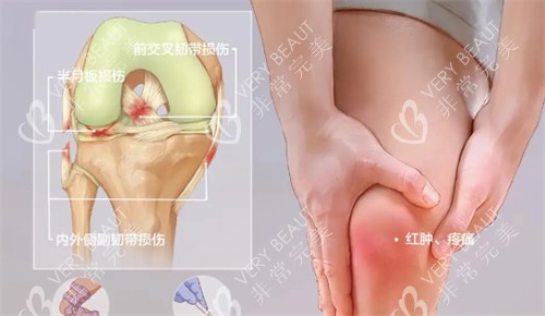 膝盖受损治疗方法