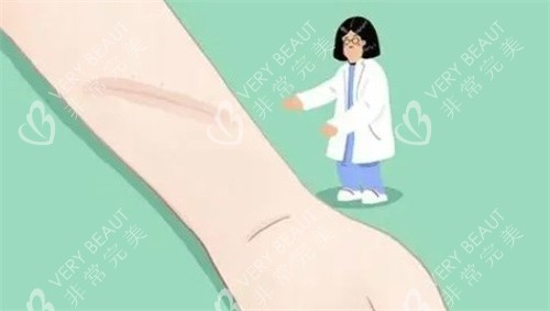 疤痕卡通圖