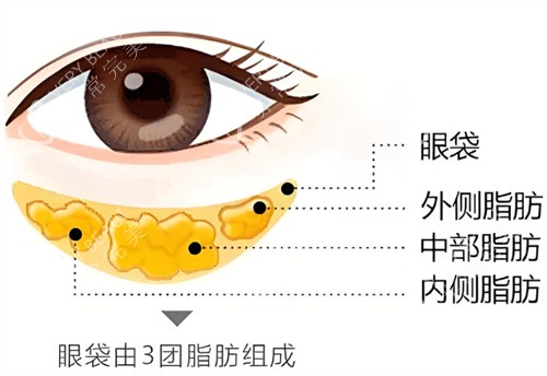 眼袋构成