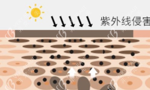 眼部色素沉积形成黑眼圈