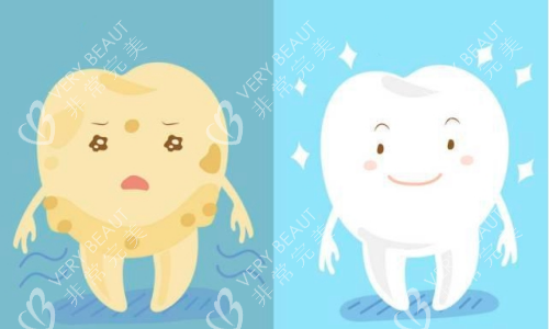 牙齿美白前后对比图