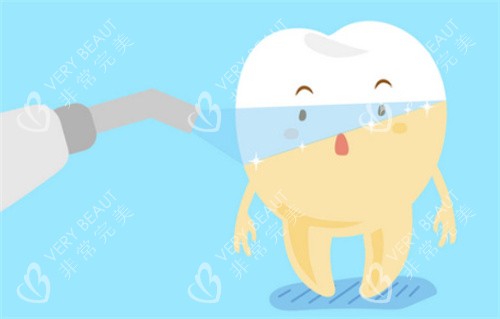 牙齿美白前后对比