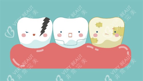 牙齿美白对比卡通图