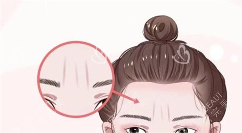 馒化脸出现的问题