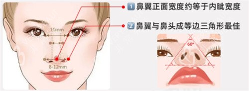 鼻翼缩小鼻翼图