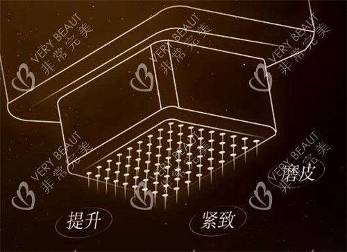黑曜双波黄金微针功效