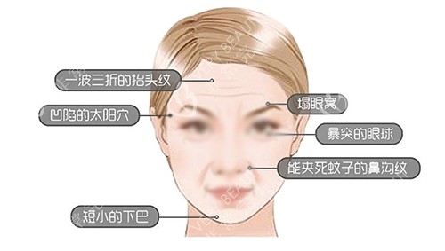 面部凹陷