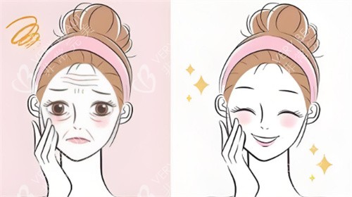 脸部抗衰对比