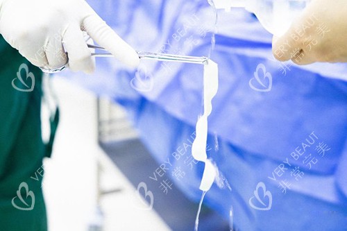 3d生物束带紧缩术实物图