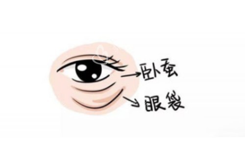 卧蚕、眼袋区别图
