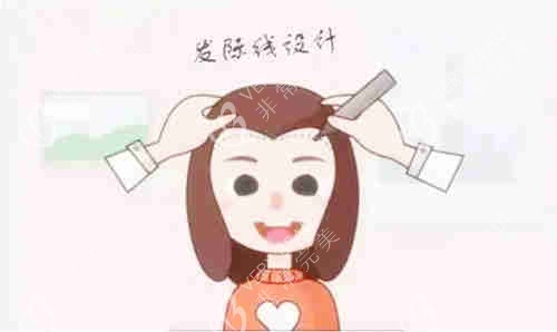 植发设计图示
