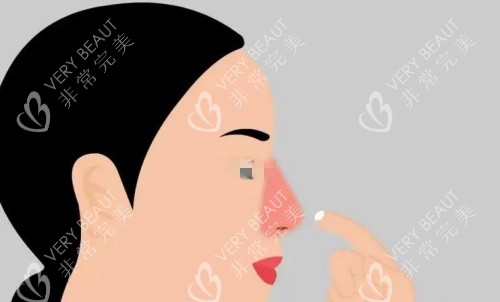酒糟鼻侧面示意图