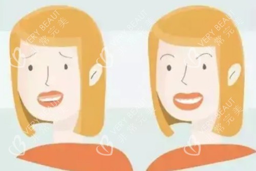 凸嘴改善对比图