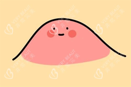 眼角脂肪粒示意图