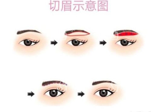 提眉