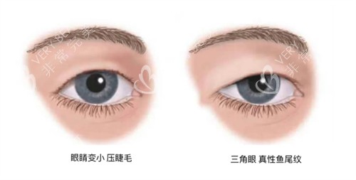 需要提眉的状况