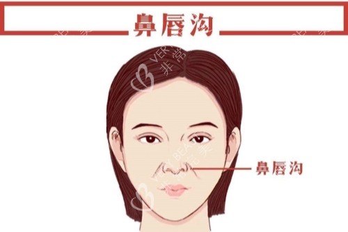 鼻唇沟卡通图