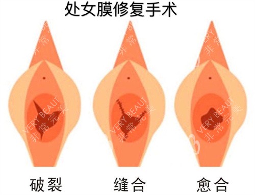 南京嘉怡美手术室