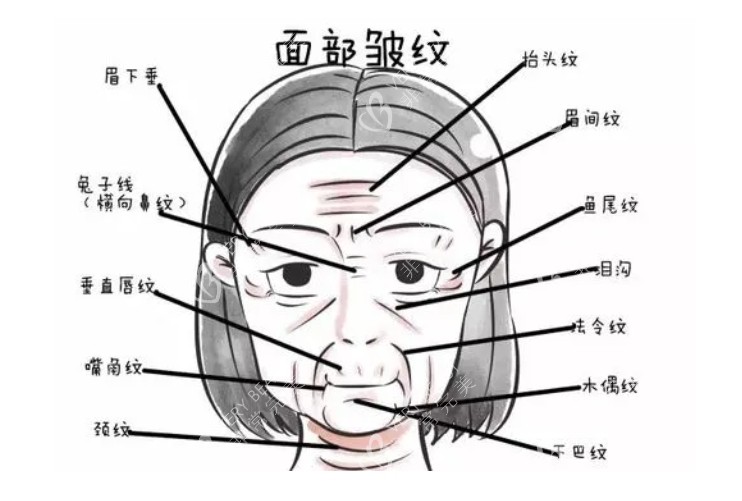 面部細(xì)紋部位展示圖