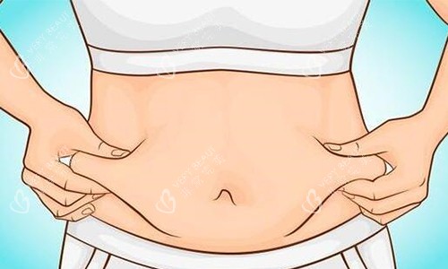 腰腹环吸前动画展示图