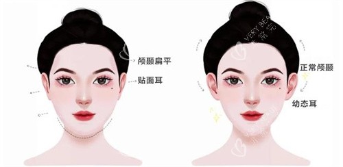 幼态脸主要做的项目