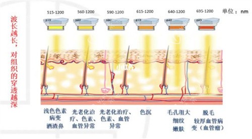 M22光子嫩肤不同波长