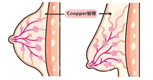 乳房下垂韧带组织对比