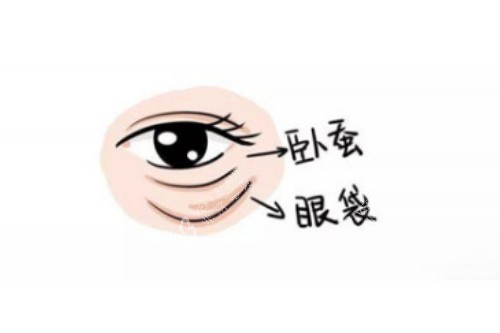 卧蚕、眼袋区别图