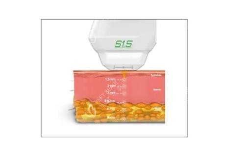 双逆博士的示意图