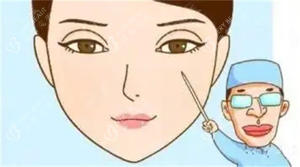 双眼皮疤痕修复手术