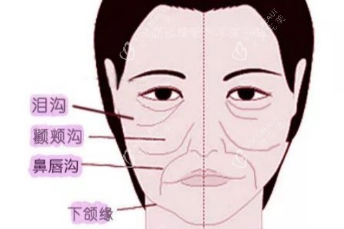 面部皱纹卡通图