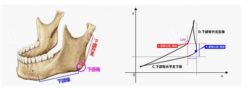 北京圣嘉新医疗美容医院张立天下颌角手术设计示意图