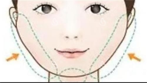 磨骨手术的部位