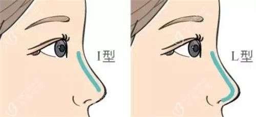 隆鼻不同形态假体呈现图