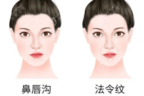 鼻唇沟和法令纹卡通对比图