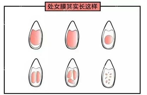 处女膜动画演示图