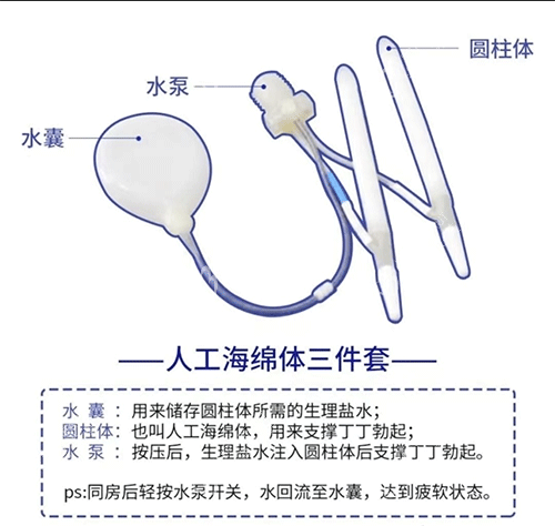 人工海绵体三件套