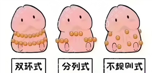 入珠手术动画3