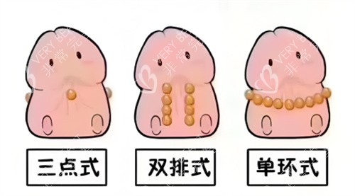 入珠手术动画2