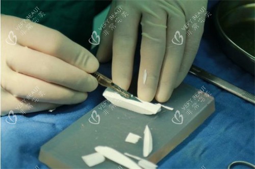 隆鼻手术正在雕刻的膨体