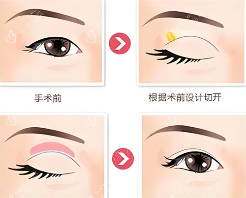 全切设计图
