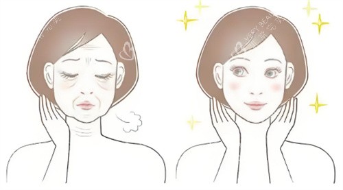 脸部抗衰前后对比