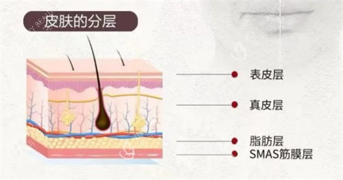 softwave索夫波适用皮肤层次